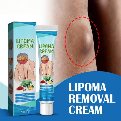 Lipoma Removal Cream Plant Extract Tumors Treat Skin Swelling Ointment Relief