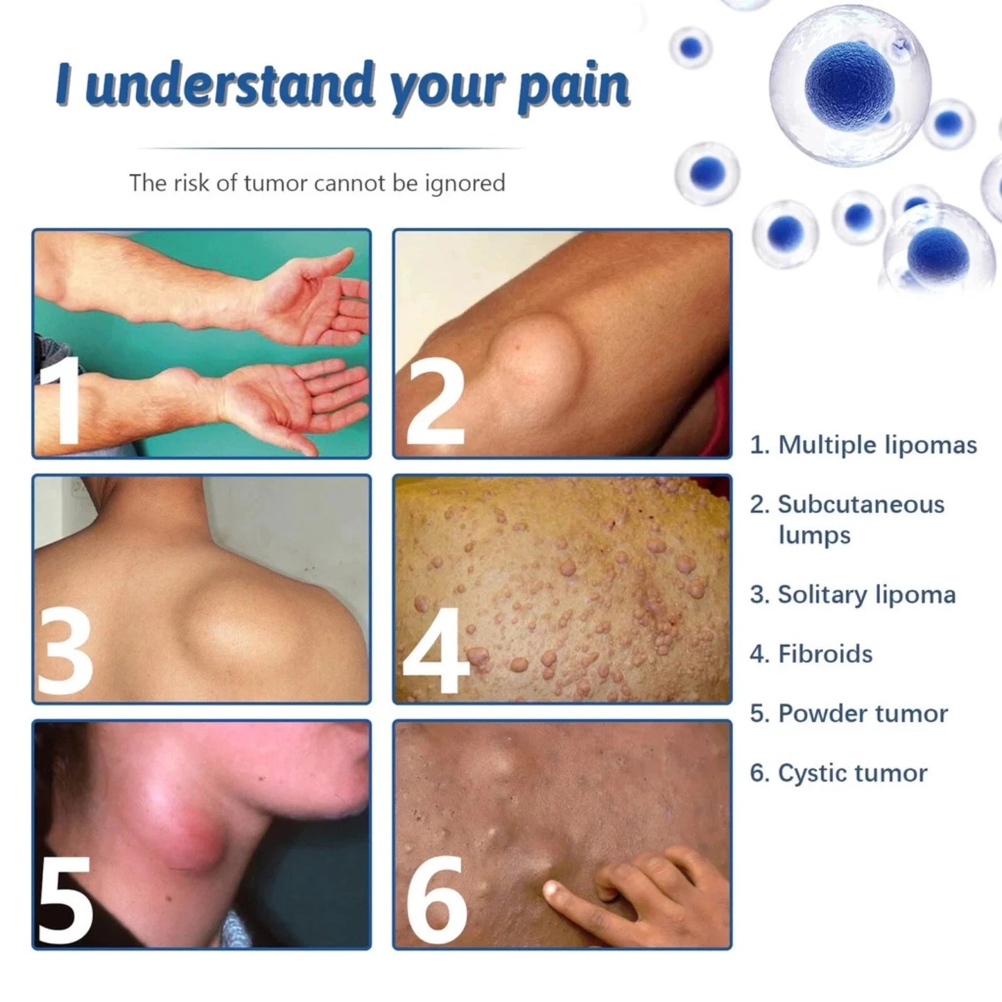 Lipoma Removal Cream Plant Extract Tumors Treat Skin Swelling Ointment Relief